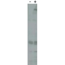 PARK8 Antibody