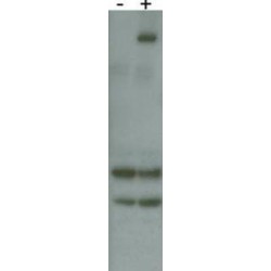 Leucine-Rich Repeat Serine/threonine-Protein Kinase 2 (PARK8) Antibody