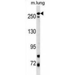 Leucine-Rich Repeat Serine/threonine-Protein Kinase 2 (PARK8) Antibody
