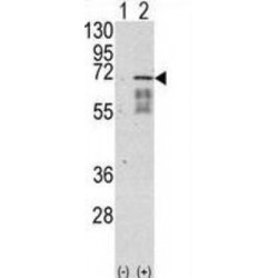 Activin Receptor Type IA Antibody