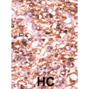 Activin A Receptor Type 2B (ACVR2B) Antibody