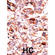 AarF Domain Containing Kinase 5 (ADCK5) Antibody