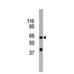 AarF Domain Containing Kinase 5 (ADCK5) Antibody