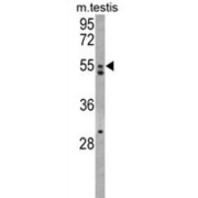 Anti-Mullerian Hormone Receptor Type 2 (AMHR2) Antibody