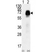 Anti-Mullerian Hormone Receptor Type 2 (AMHR2) Antibody
