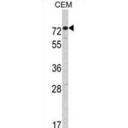 Anti-Mullerian Hormone Receptor Type 2 (AMHR2) Antibody