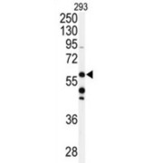 Chaperone Activity of Bc1 Complex-Like (CABC1) Antibody