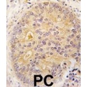 Calcium/calmodulin-Dependent Protein Kinase Kinase 2 (CAMKK2) Antibody