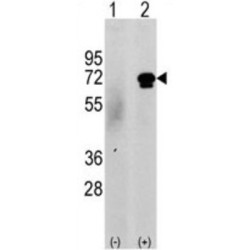 Calcium/calmodulin-Dependent Protein Kinase Kinase 2 (CAMKK2) Antibody
