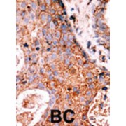 Lemur Tyrosine Kinase 2 (LMTK2) Antibody