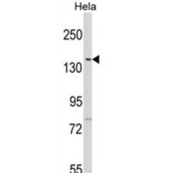 Lemur Tyrosine Kinase 2 (LMTK2) Antibody