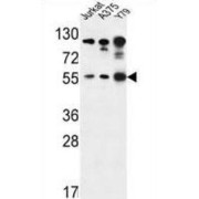 abx033199