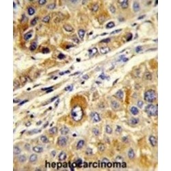Serine/threonine-Protein Kinase Greatwall (MASTL) Antibody