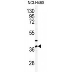 Pantothenate Kinase 3 (PANK3) Antibody