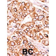 Phosphoinositide Kinase, FYVE-Type Zinc Finger Containing (PIP5K3) Antibody