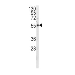 Pyruvate Kinase PKM (PKM) Antibody