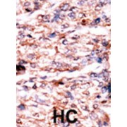 Serine/threonine-Protein Kinase H1 (PSKH1) Antibody