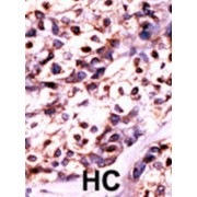 WB analysis of extracts of HeLa cell line lysate, using Uridine-Cytidine Kinase 2 (UCK2) Antibody.
