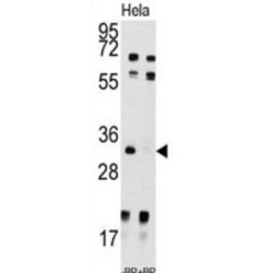 Uridine-Cytidine Kinase 2 (UCK2) Antibody