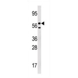 Uridine-Cytidine Kinase-Like 1 (URKL1) Antibody