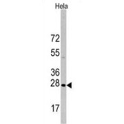 Heat Shock Protein 27 (HSP27) Antibody