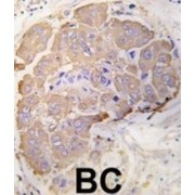 Heat Shock Protein Beta-1 (HSPB1) Antibody