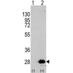 Heat Shock Protein Beta-1 (HSPB1) Antibody