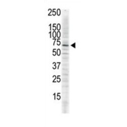 Calcium/calmodulin Dependent Protein Kinase II Delta (CAMK2D) Antibody