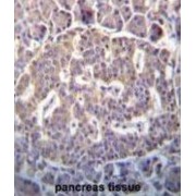 N-Terminal Kinase-Like Protein (SCYL1) Antibody
