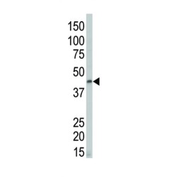 Death-Associated Protein Kinase 2 (DAPK2) Antibody