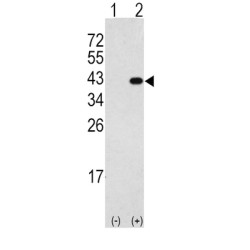 Death-Associated Protein Kinase 2 (DAPK2) Antibody