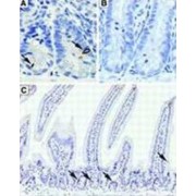 Doublecortin-Like And CAM Kinase-Like 1 (DCAMKL1) Antibody