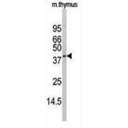 DAP Kinase-Related Apoptosis-Inducing Protein Kinase 1 (DRAK1) Antibody