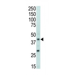 Mitogen-Activated Protein Kinase 11 (MAPK11) Antibody