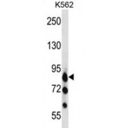 Serine/Threonine-Protein Kinase P78 (MARK3) Antibody