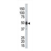 Phosphorylase Kinase Catalytic Subunit Gamma 2 (PHKG2) Antibody