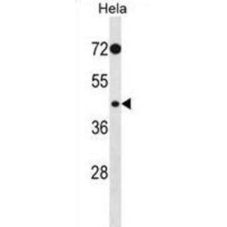 Phosphorylase Kinase Catalytic Subunit Gamma 2 (PHKG2) Antibody
