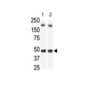 Sphingosine Kinase 1 (SPHK1) Antibody