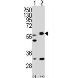 Serine/threonine-Protein Kinase STK11 (STK11) Antibody