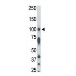 Serine/Threonine Kinase 31 (STK31) Antibody