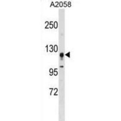 Serine/Threonine Kinase 31 (STK31) Antibody