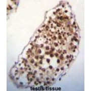 SNF-Related Serine/threonine-Protein Kinase (SNRK) Antibody