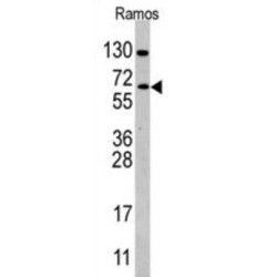 Cell Division Cycle 25B (CDC25B) Antibody