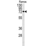 Cell Division Cycle 25B (CDC25B) Antibody