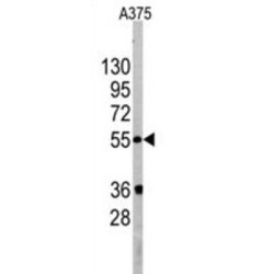 PDZ Protein Interacting Specifically With TC10 (PIST) Antibody