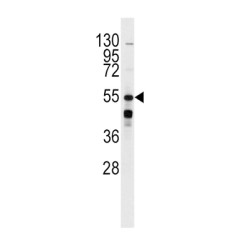 Beta-2 Adrenergic Receptor (ADRB2) Antibody