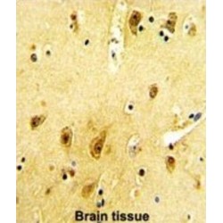 Beta-2 Adrenergic Receptor (ADRB2) Antibody