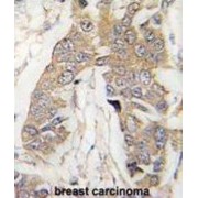 Cancer Susceptibility 3 (CASC3) Antibody