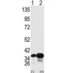 Prohibitin-2 (PHB2) Antibody