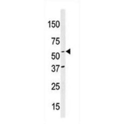 NEDD8 Activating Enzyme E1 Subunit 1 (NAE1) Antibody